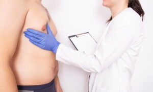 Badanie lekarskie klatki piersiowej mężczyzny w diagnostyce ginekomastii